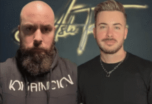 How modern hair transplants are re -designing Hirc on the shape of M natural » Content Creation How modern hair transplants are re -designing Hirc on the shape of M natural