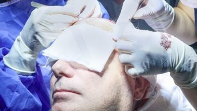 Reducing the risk of scar after hair transplantation with Vita technology
